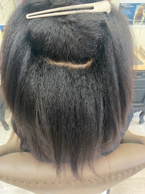 alt="大阪吹田で縮毛矯正 前 ハーフの女性の根元から強いチリチリ縮毛"
