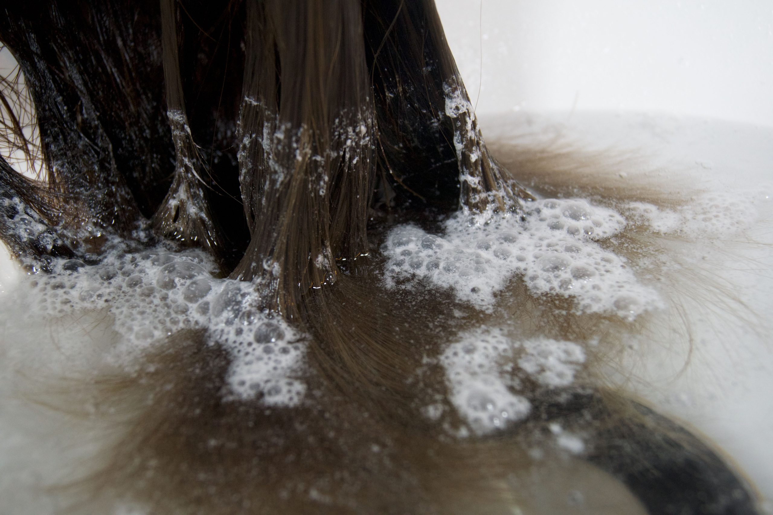 エイジング毛は“頭皮のたるみ”から始まる。